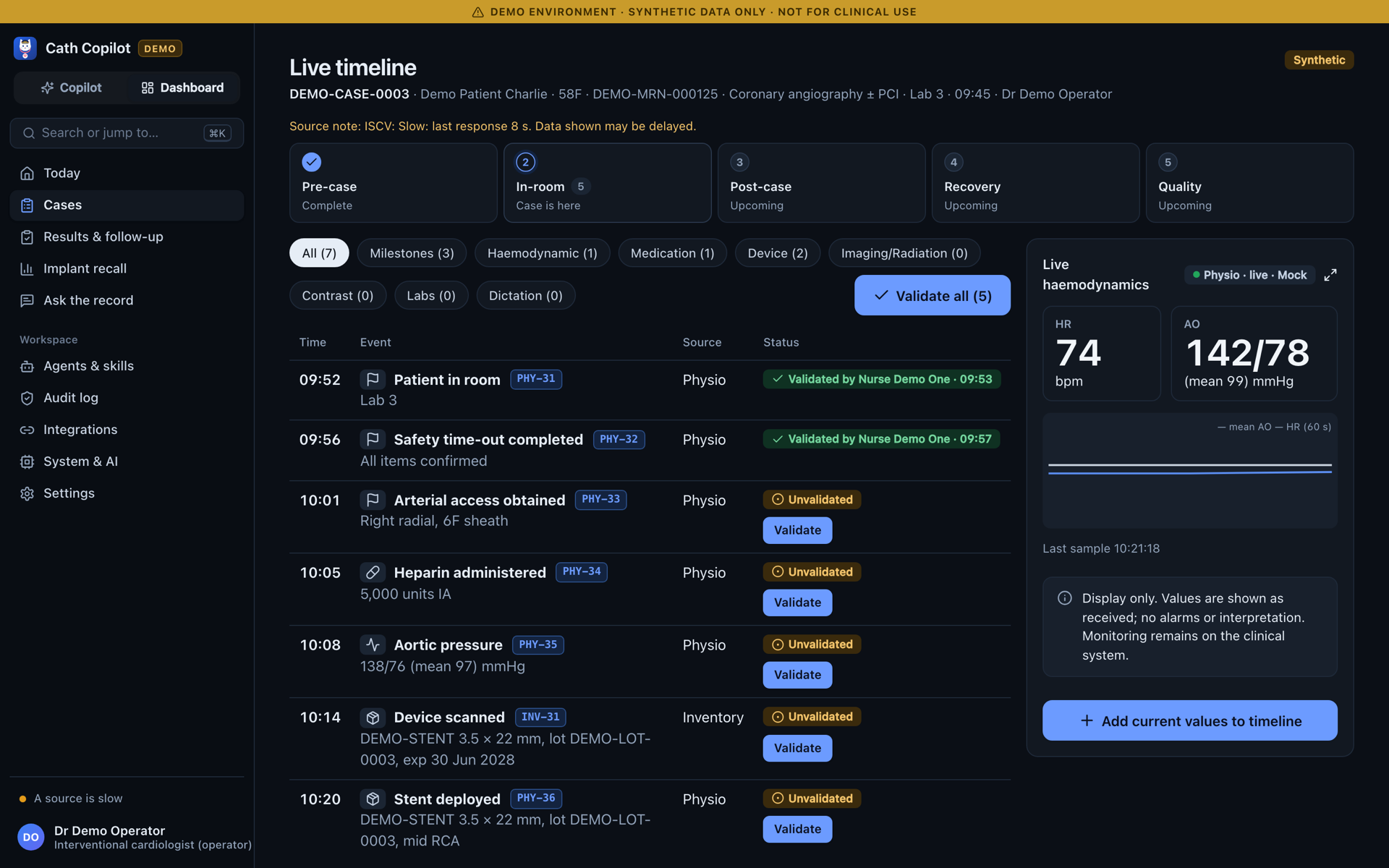 Cath Copilot live timeline in the dim in-room theme with events awaiting validation and live haemodynamics