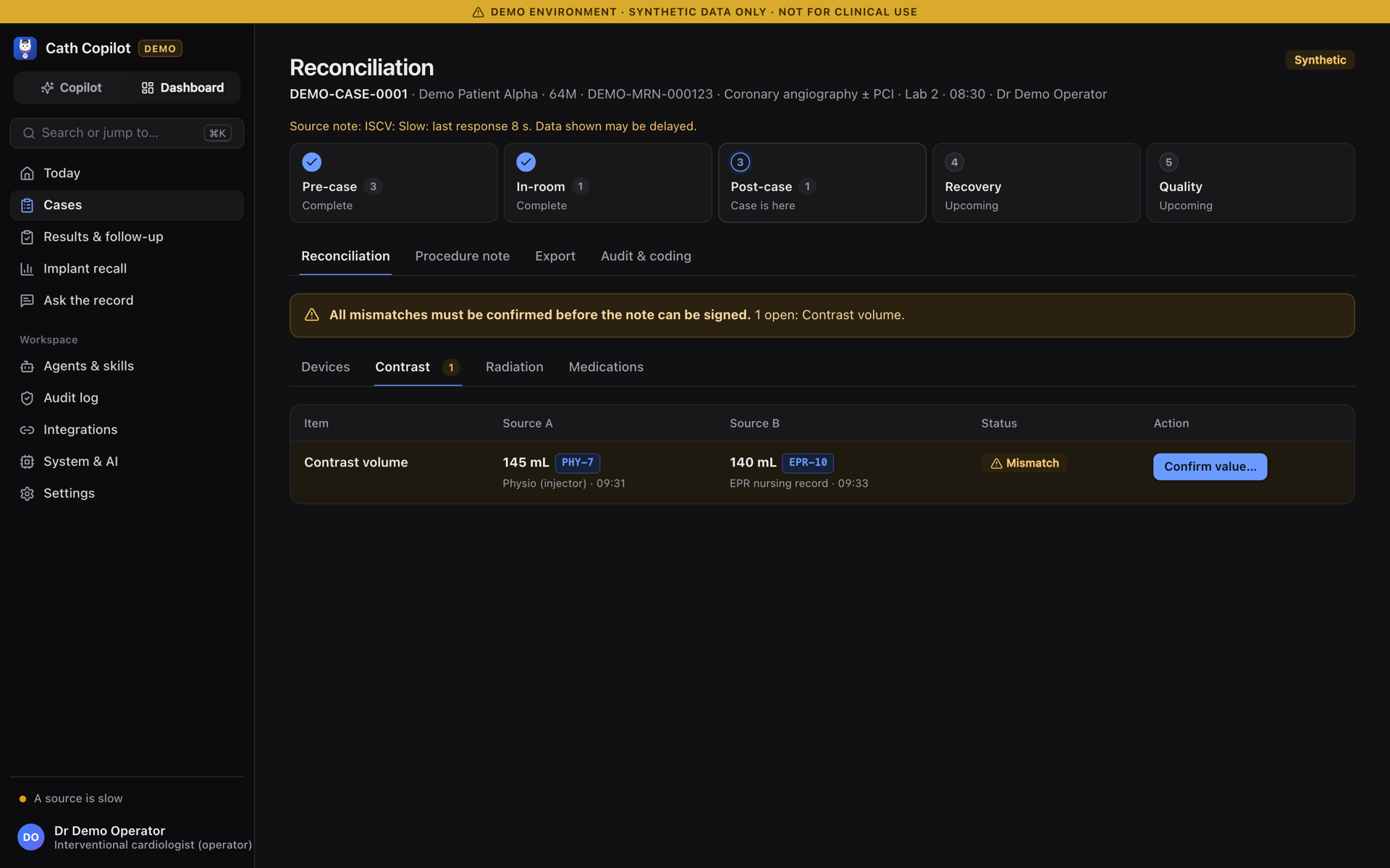 Cath Copilot reconciliation screen in dark mode showing a contrast volume mismatch between the physiology system and the EPR